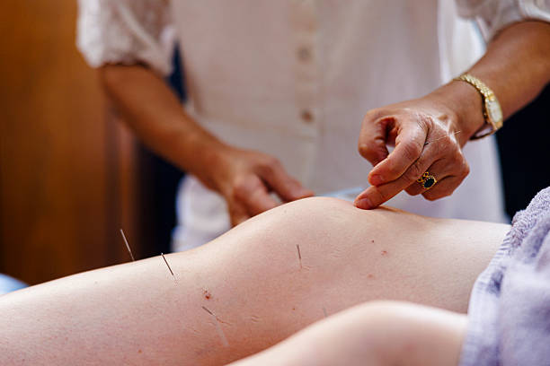 acupuncture for neuropathy